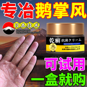 【可根冶】日本进口鹅掌风药膏手干裂小水泡手足藓脱真菌感染专用