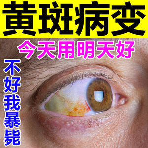 黄斑病变眼药水去眼睛发黄浑浊眼白出血眼球中老年眼底泛黄滴眼液
