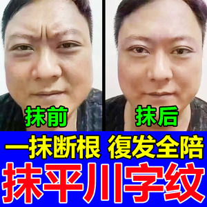 日本川字纹祛男女额头贴抗皱去除神器抬头纹消除提拉紧致法令纹膏