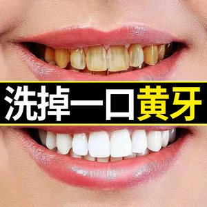 美牙神器人仁齿白金洗牙粉清洁口腔去牙垢牙结石烟熏牙美白牙齿