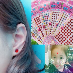 婴儿美人痣贴小红点