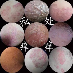 女人下面的阴毛