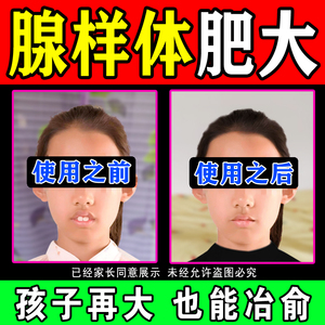 【论效果没输过】儿童腺样体肥大面容矫正器贴鼻塞凸牙打鼾口呼吸