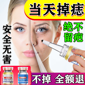 00同款货源开心果76770799点痣药膏去斑去痣的药膏无痕正品点祛痦