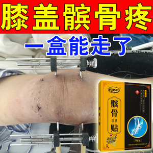 膝盖疼痛髌骨贴软化症髌腱--炎半月板--损伤积水滑膜积液专用膏贴