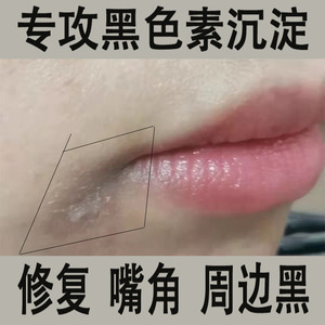 唇部护理周围淡化唇周去黑嘴角发黑去除美白去黑色素嘴边去黑暗沉