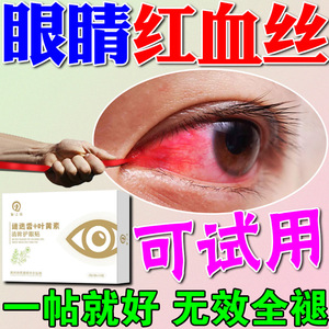眼睛红血丝修复去除眼睛清澈去黄消除干涩模糊眼贴缓解眼疲劳神器