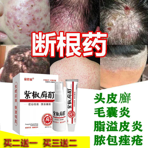 皮癣药膏真菌