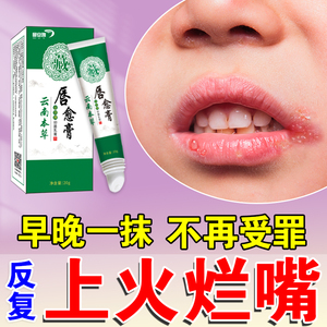80茹春堂医疗器械旗舰店天猫唇炎专用药膏口角炎儿童成人嘴巴上火