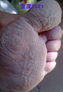 脚底板掉皮脚气买2送1 扶氏堂宝宝霜抑菌药膏婴儿新生肤乐霜婴宝