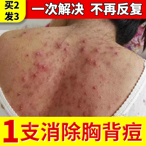 9022人付款淘宝背上长有痘痘后背祛痘喷雾去背部胸前胸口身体去除螨虫