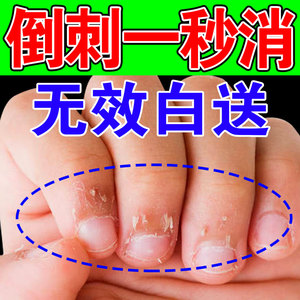 手指倒刺营养油儿童成人指甲倒刺干裂起皮疼痛专用护甲修复软化剂