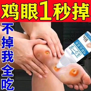 治鸡眼