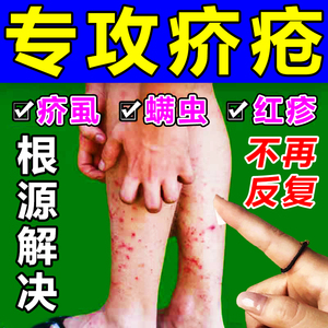 疥疮特效药硫磺软膏成人儿童宝宝去除虱阴囊结节疥虫疥螨疥疮专用