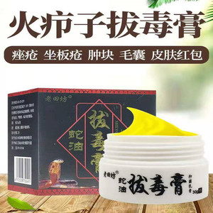 火疖子拔毒膏药疙瘩痘痘红肿大肿硬块浓疮包毛囊闷头吸脓神器外用