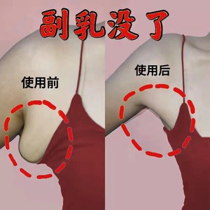 【小红书推荐 9天去副乳】颈部淋巴神器改善贴腋下结节疏通消除
