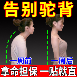 治疗驼背神器矫正