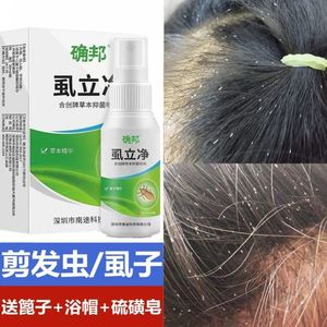 除剪发虫螨虫卷发虫小女孩头上长虱子药的药治儿童男头痒止痒专用