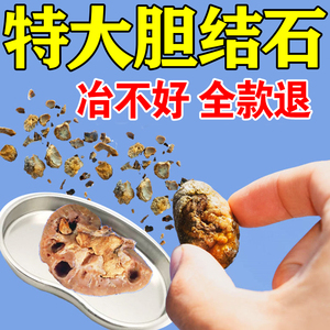 万康善仁堂淘宝胆结石溶石化石胆结石中草药贴非茶肾结石克星金钱草