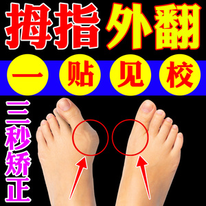 大拇指外翻鞋垫