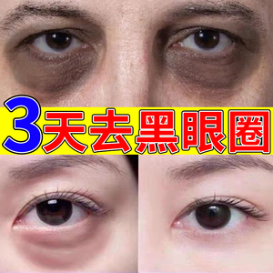 黑眼圈去除学生