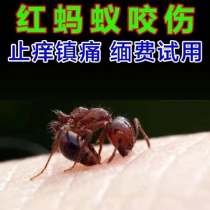 治疗臭虫螨虫跳蚤黑蚂蚁咬药被隐翅虫叮咬伤止痒红蚂蚁咬专用药膏