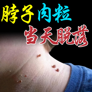 去脖子上的小肉粒【可拔拫】丝状疣颈部扁平跖疣瘊净瘊子去除神器