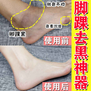 脚脖子防晒神器治脚踝晒伤修复皮肤手指关节膝盖手肘晒黑快速变白