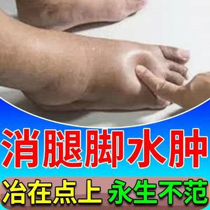 消水肿神器药下肢利尿排水肿利尿剂消脸部老人去水肿脚肿药贴