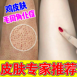 毛周角化症去鸡皮肤疙瘩药毛膏囊角化毛孔堵塞疏通马拉色菌沐浴露
