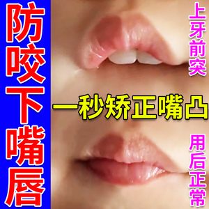 咬嘴唇矫正器儿童前庭盾纠正小孩子口呼吸日本戒宝宝防咬下唇神器