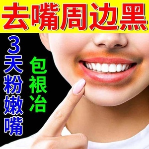 【唇角黑】唇角黑品牌,价格 - 阿里巴巴