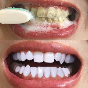 【2022南京同仁堂爆款牙白泡沫牙膏】限时促销机不可失 失不再来