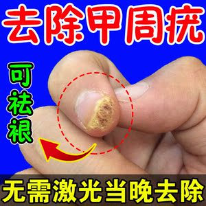 甲周疣专用药膏治甲下疣祛肉刺瘊子去除扁平尤疣手足跖疣去神根器