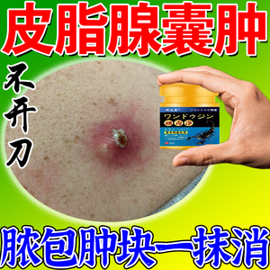 粉瘤皮脂腺囊肿膏去除皮下囊肿脂肪瘤火疖子拔毒拔脓消除硬块神器