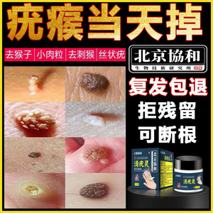 瘊疣平正品去疣灵