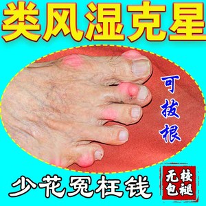 类风湿性关节炎泡脚根治王特效中治疗痛风的黑骨藤透骨止疼药膏