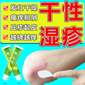 801人付款淘宝【正品保真】舒极宝宝药膏抑菌止痒膏外用皮肤瘙痒膏