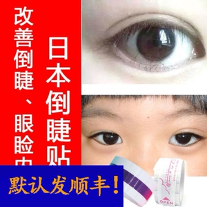 倒睫毛矫正贴倒睫毛矫正贴儿童下睫毛倒睫贴眼贴内睑外翻神器胶带