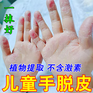 小孩手指头蜕皮手脱皮严重专用药膏儿童手脚上起皮干燥掉皮护手霜