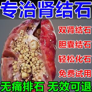 金钱草中草药肾结石排石药化石草特效专用胆尿结石溶石颗粒治疗贴