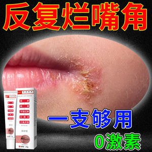 烂嘴角药膏润唇膏修护唇炎嘴唇干裂脱皮口角炎口周皮炎溃烂疱疹hv