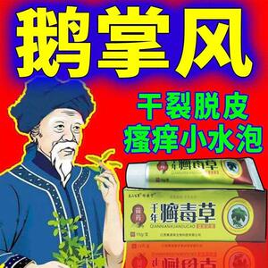 鹅掌风手癣膏手足癣真菌感染止痒手足脱皮干裂水泡湿疹顽固癣正品