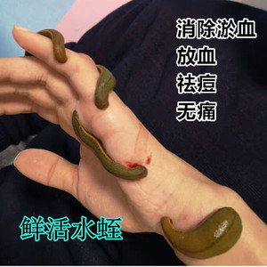 00肖瑞服饰淘宝正宗菲牛蛭活体5g每条共20条装药用水蛭 金边蚂蝗