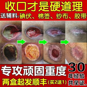华佗玉红生肌膏促进伤口生肌老人压瘡老烂腿愈合正品褥创膏33人付款
