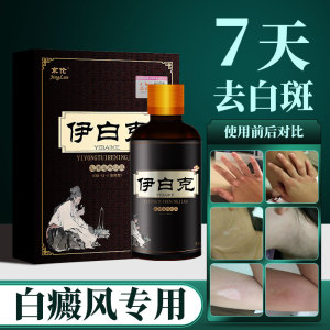 白癜风治疗外用药黑色素生长补骨脂去白斑汗斑克星专用伊白克正品