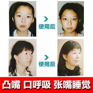 日本口呼吸矫正器防张嘴睡觉成人儿童改善突凸嘴纠正下巴唇肌训练