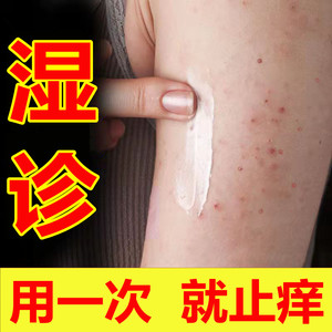 8089人付款淘宝铜钱癣止痒药膏皮炎皮肤外用专用瘙痒抑菌湿疹去根私处