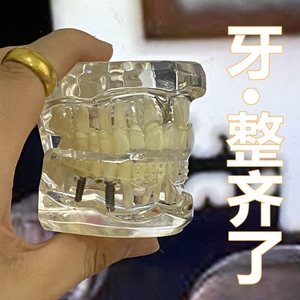 隐形牙套牙齿矫正器大人地包天龅牙牙缝儿童纠正嘴凸整牙硅胶神器