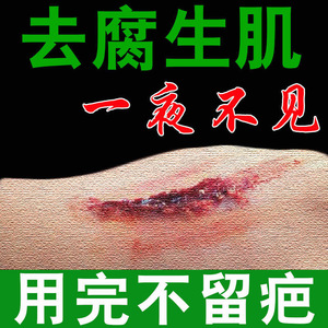 祛腐生肌膏促进伤口结痂快速修复愈合杀菌烫伤烧伤消毒水外用药膏